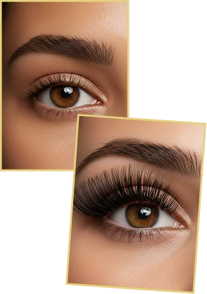 Resultado de antes e depois