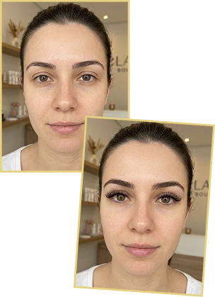 Resultado de antes e depois