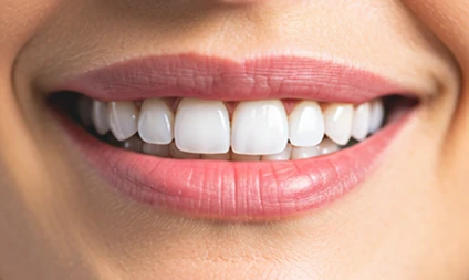 Pessoa sorrindo com dentes brancos após clareamento dental